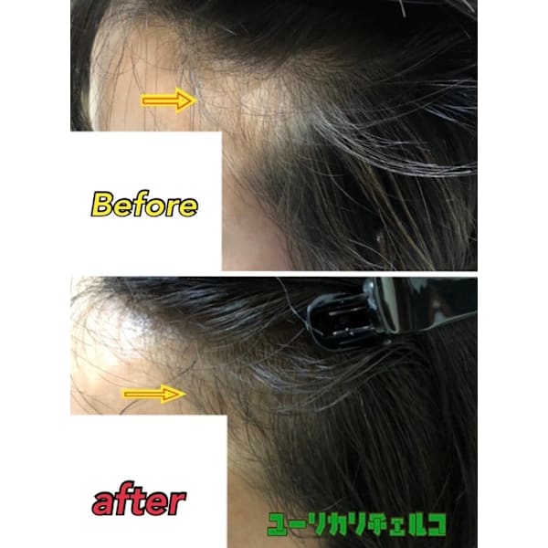 A女性限定うす毛改善率98％の実績【本格育毛促進お試しコース】詳しく相談TEL※ヘッドスパ、カット無