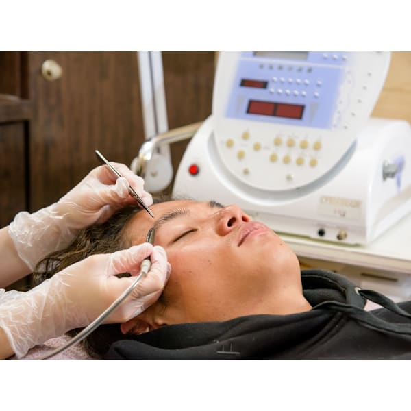 【スーパー電気脱毛（美容電気脱毛】1本1本確実に抜ける！白髪も抜ける★ヒゲ脱毛初回体験1000円★