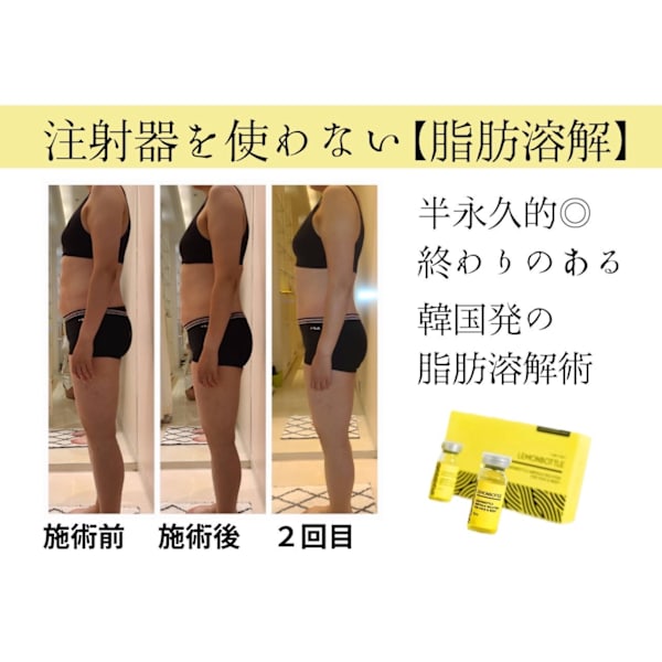 【半永久的◎脂肪分解】レモンボトル6cc広範囲に打ち放題★¥25300→¥11000