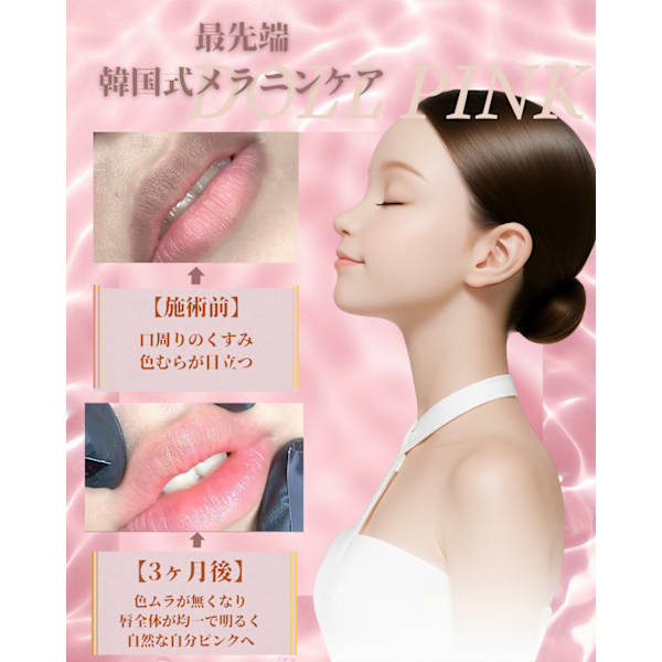 最新メラニンケア💋唇のくすみ・黒ずみケア☆自然な血色と艶を取り戻すメラニンケア