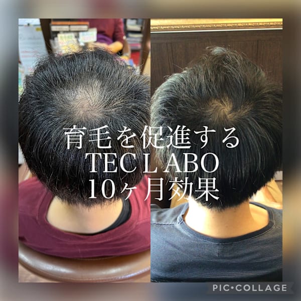 TECH LABO頭皮環境改善毛髪ケア！初回限定！