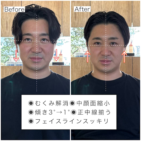 整顔ヘッドスパ＋頭皮クレンジング￥13,500