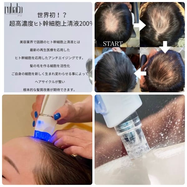 【予防&再生美容】最高濃度ヒト幹細胞培養液スパ、デンキバリブラシ、エアバリ導入