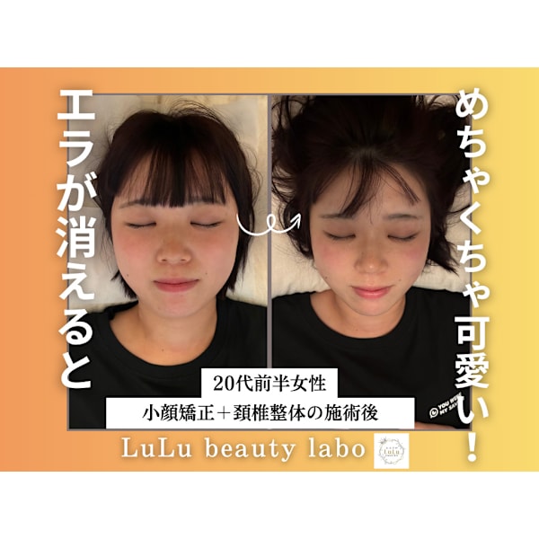 【先着残り2名！】小顔矯正&頚椎整体《80分コース》¥13,200→¥3,900