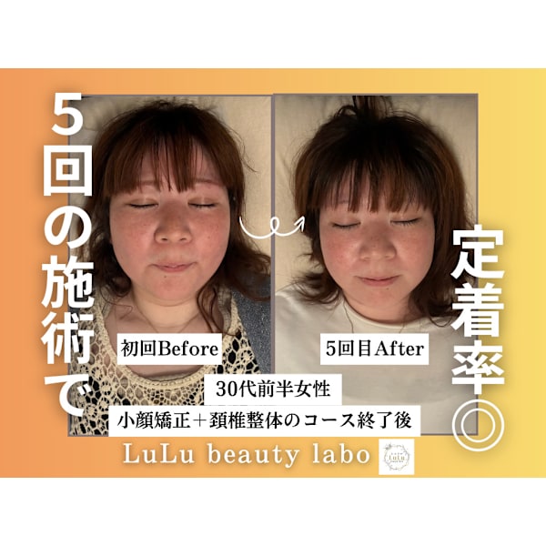 【先着残り3名！】小顔矯正&小顔リンパ《80分コース》¥13,200→¥3,900