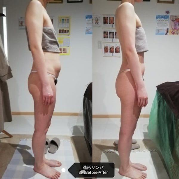 ［BODY体験］ ボディー悩みの初回 カウンセリング&ご体験 90分　¥8800