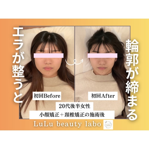 【３日間限定ゲリラ価格！】小顔矯正&頚椎整体《80分コース》¥13,200→¥2,200