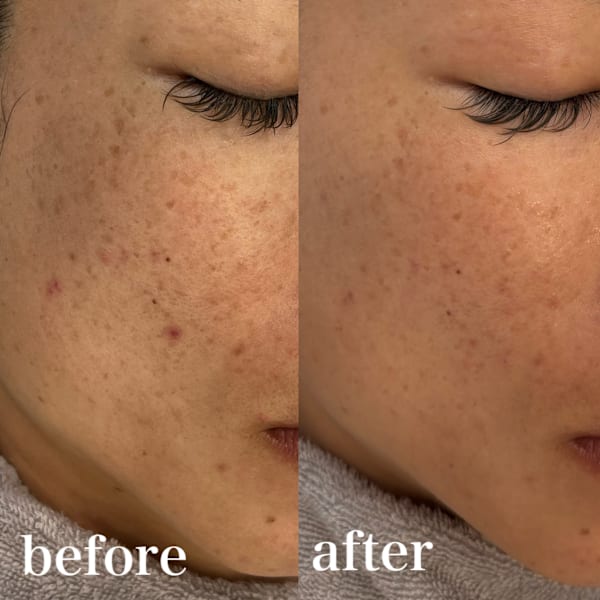 フェイシャルマッサージ10分(ノーメイクに限る)