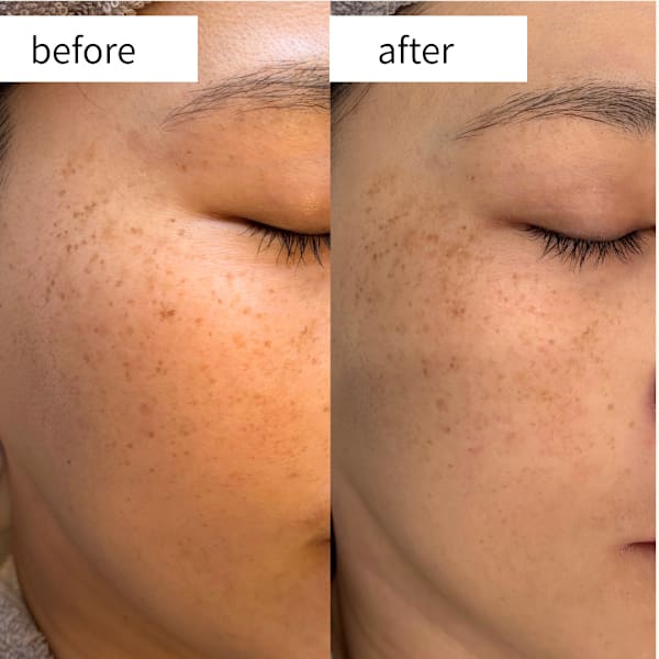 クレンジング+洗顔+マッサージ20分