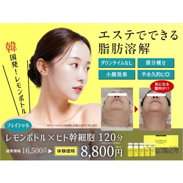 即小顔★頬～あご下脂肪溶解液「レモンボトル」ＦＡＣＥ３ｃｃ打ち放題　16500円→8800円