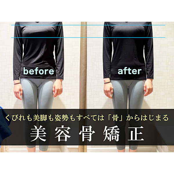 美容骨矯正で姿勢から美しく。肩こり・腰痛を根本ケアし、1回で驚きの見た目変化を叶える。