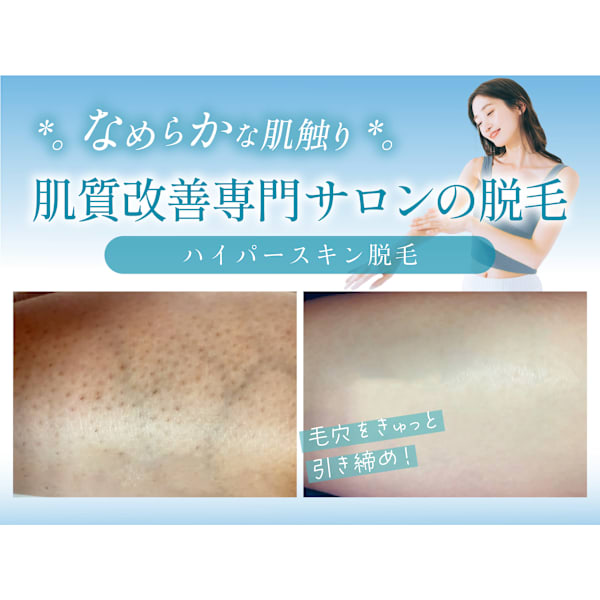 【敏感肌◎】ハイパースキン脱毛 10ヵ所体験 今なら家庭用脱毛器プレゼント★