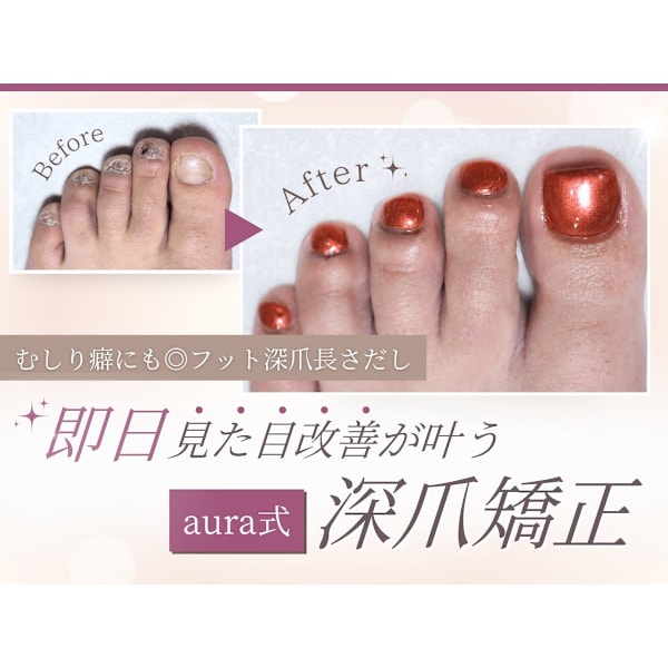 【サンダル前に♪】1回で見た目UP♪フット長さ出し(10本)+ワンカラー ※ご新規様限定※