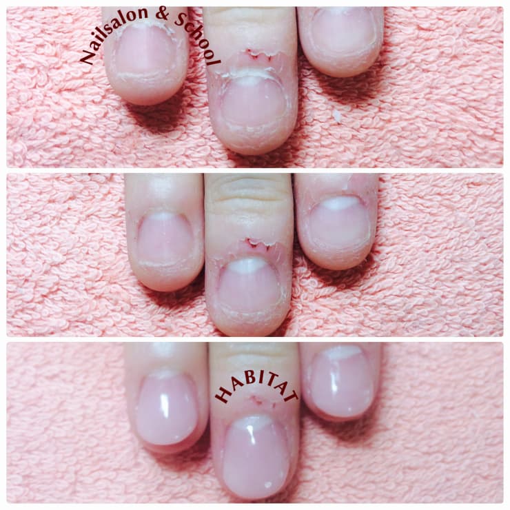 自爪育成 深爪矯正 爪のお悩みの相談お受けいたします Nail Salon Sunawo ネイルサロン スナオ のこだわり特集 ネイル まつげサロンを予約するなら楽天ビューティ