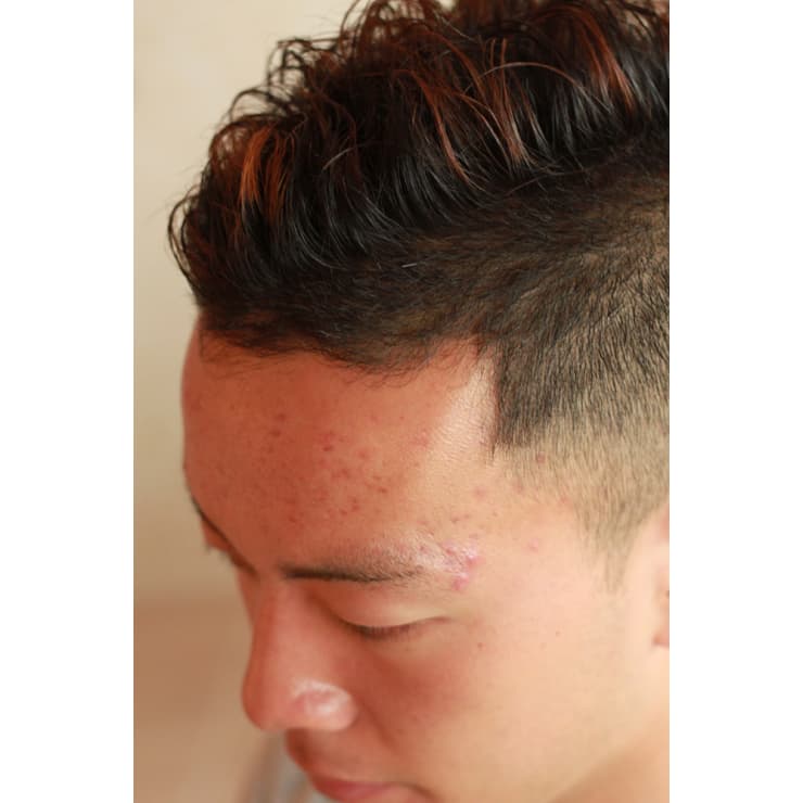 クリロナ風ツーブロック Hair Desing Aprile ヘアーデザインアプリーレ のヘアスタイル 美容院 美容室を予約するなら楽天ビューティ