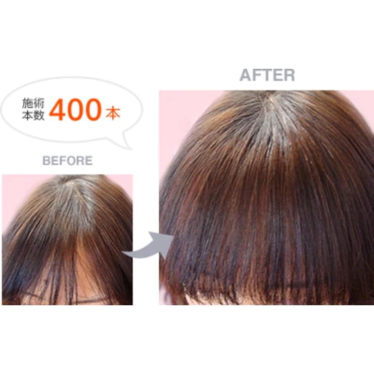 街のサロンで髪を増やす Cut Esthe やまもと カットアンドエステ ヤマモト のこだわり特集 美容院 美容室を予約するなら楽天ビューティ 街のサロンで髪を増やす Cut Esthe やまもと カットアンドエステ ヤマモト のこだわり特集 美容院 美容室を予約するなら楽天ビューティ
