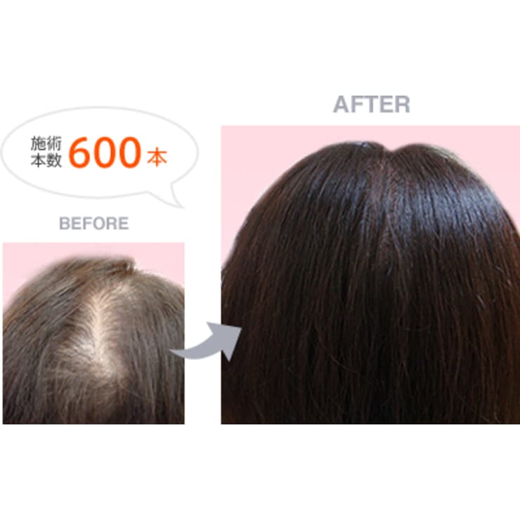 街のサロンで髪を増やす Cut Esthe やまもと カットアンドエステ ヤマモト のこだわり特集 美容院 美容室を予約するなら楽天ビューティ 街のサロンで髪を増やす Cut Esthe やまもと カットアンドエステ ヤマモト のこだわり特集 美容院 美容室を予約するなら楽天ビューティ