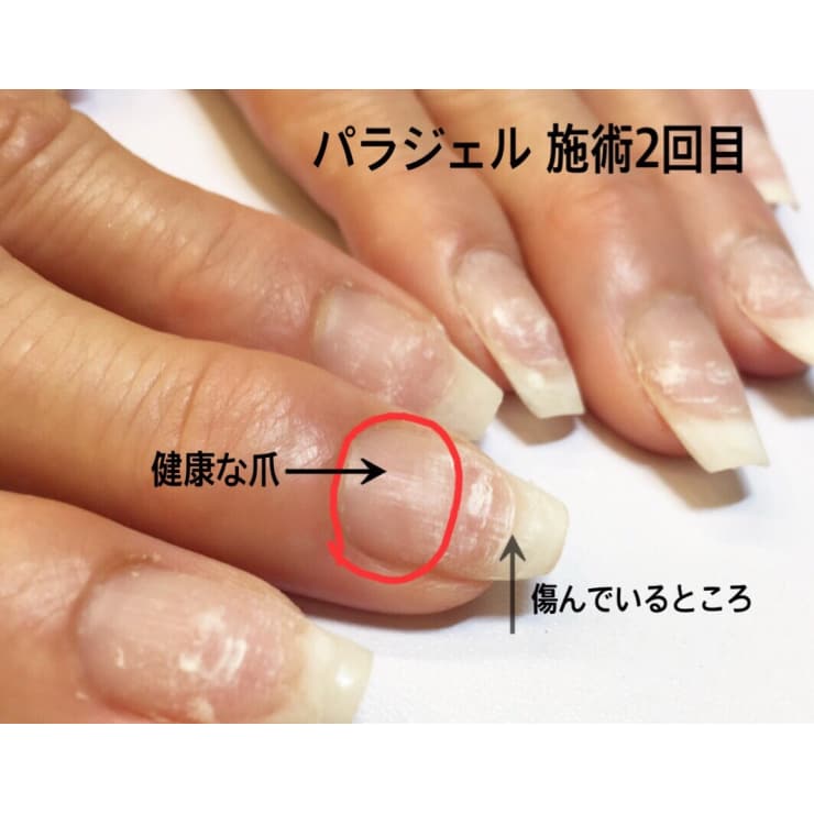 自爪が薄い方や自爪の傷みが気になる方に パラジェル Nail Gallery Avant 塚口店 アヴァン のこだわり特集 ネイル まつげサロンを予約するなら楽天ビューティ