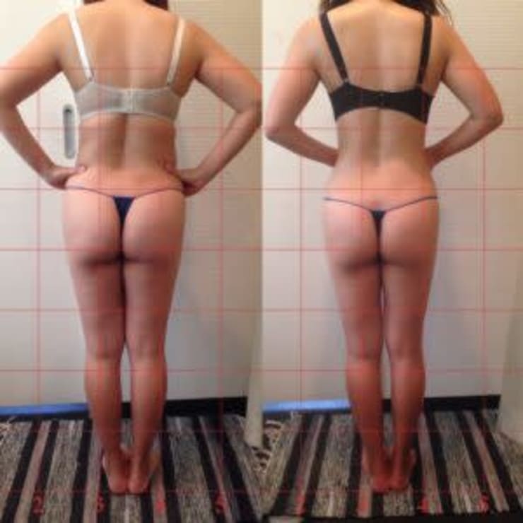 目指せ ３ｋｇ凸凹脂肪セルライトさよならコース 90分6 800円 Health Beauty Produce J O ジェイオー のこだわり特集 エステサロンを予約するなら楽天ビューティ