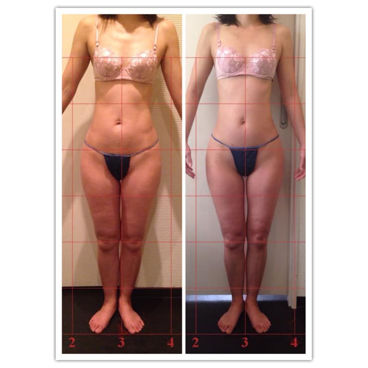 エルセーヌNewノンセリュクイックダイエットむくみセルライト