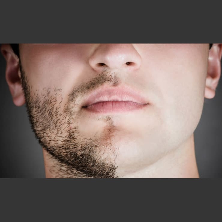 痛みを最小限に抑えるメンズ脱毛 男性が気軽に足を運べる脱毛サロン Herves エルベ のこだわり特集 エステサロンを予約するなら楽天ビューティ