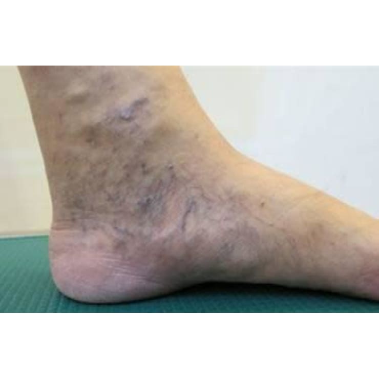 脚のむくみ 静脈が黒く 血液の流れが悪いに なごみー ナゴミー のこだわり特集 リラク マッサージサロンを予約するなら楽天ビューティ