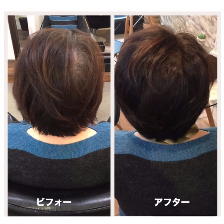 本気で薄毛を改髪されたい方限定 サロントリートメント 自宅でのヘアケアセット プレゼント付き クレッセント クレッセント のこだわり特集 美容院 美容室を予約するなら楽天ビューティ