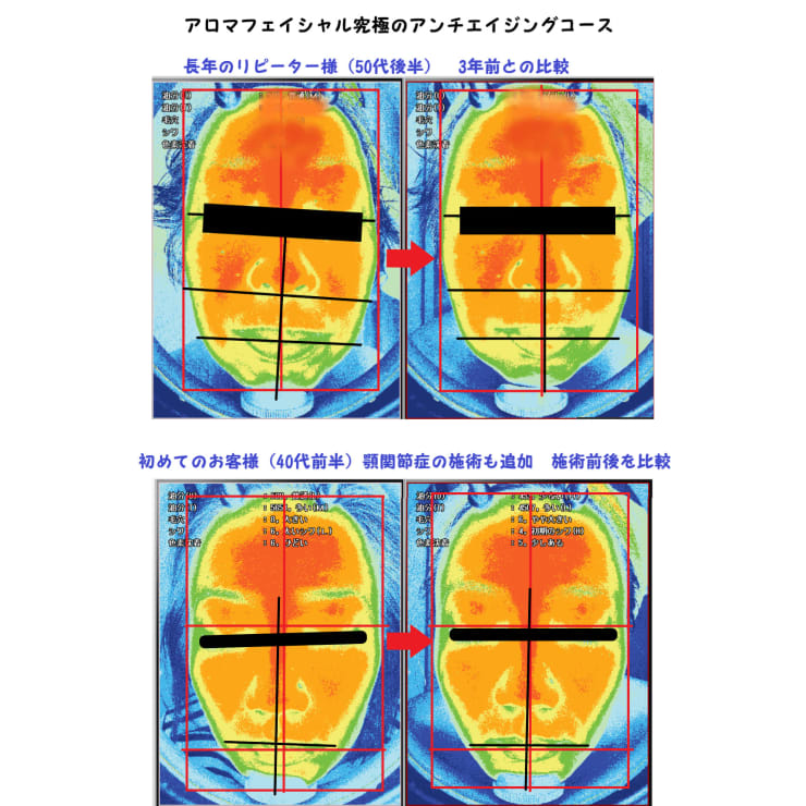 顎関節や頭蓋骨の歪み 慢性眼精疲労 顔の左右非対称を整える施術をトレーニングで受けれられます G Salon ジーサロン のこだわり特集 リラク マッサージサロンを予約するなら楽天ビューティ
