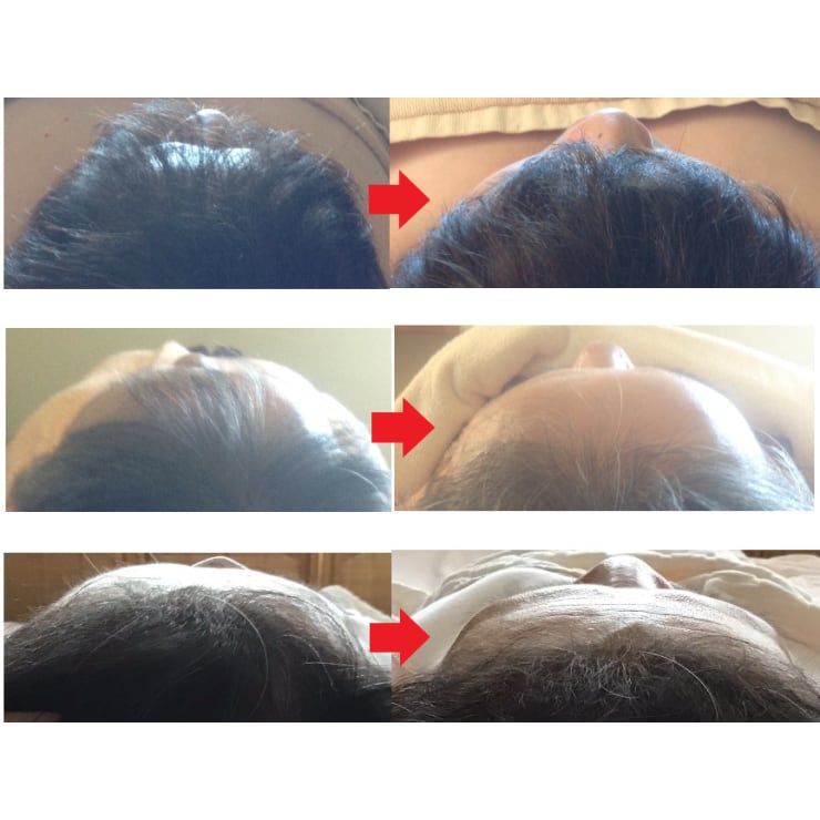 頭蓋骨の歪みや顎関節を整えると整形もしていない顔の形状が整います G Salon ジーサロン のこだわり特集 エステサロンを予約するなら楽天ビューティ