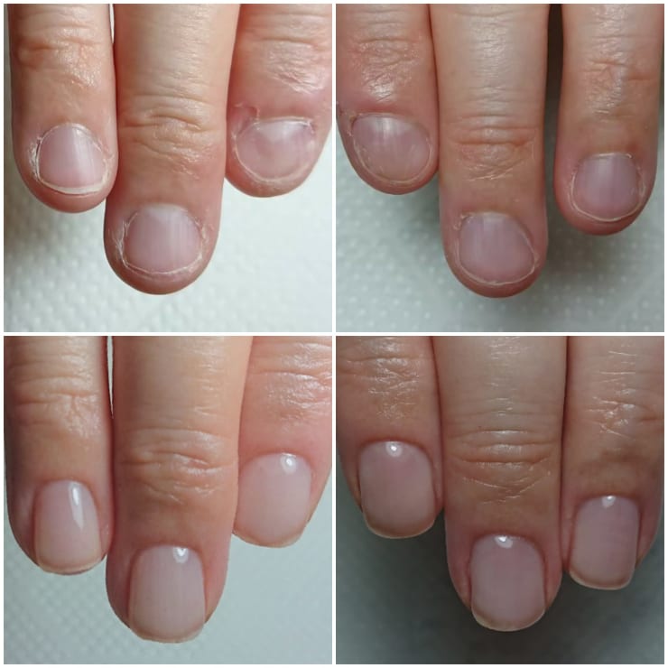 深爪ケアコース 美爪育成ネイル 頭蓋骨小顔矯正サロン Jeliss ビツメイクセイネイル ズガイコツコガオキョウセイ ジェリス のネイルデザイン ネイル まつげサロンを予約するなら楽天ビューティ