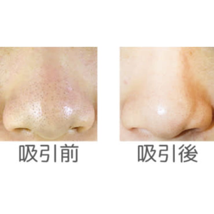 イチゴ鼻サヨナラ メンズサロン 嗜み 豊橋本店 メンズサロン タシナミ トヨハシホンテン のこだわり特集 エステサロンを予約するなら楽天ビューティ