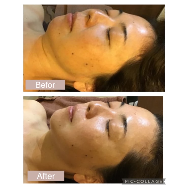 ❤多機能1台8役❣フランスのメーカーとの共同開発で驚愕のエステ効果