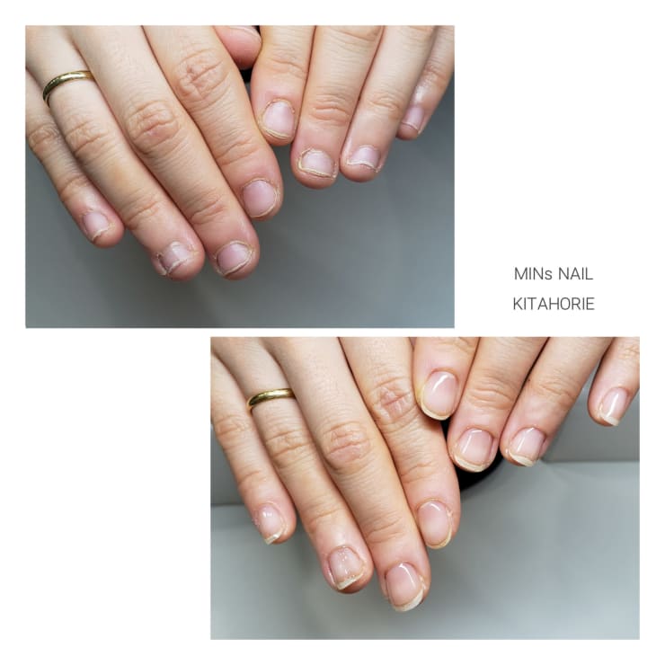 噛み爪 深爪 育成コース Before After Mins Nail ミンスネイル のこだわり特集 ネイル まつげサロン を予約するなら楽天ビューティ 噛み爪 深爪 育成コース Before After Mins Nail ミンスネイル のこだわり特集 ネイル まつげサロン を予約するなら楽天ビューティ