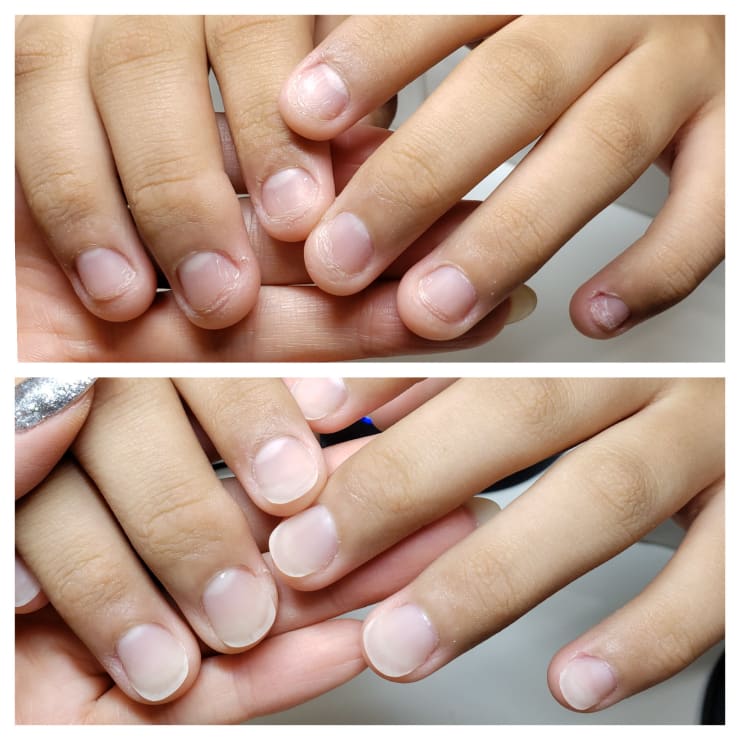 噛み爪 深爪 育成コース Before After Mins Nail ミンスネイル のこだわり特集 ネイル まつげサロン を予約するなら楽天ビューティ 噛み爪 深爪 育成コース Before After Mins Nail ミンスネイル のこだわり特集 ネイル まつげサロン を予約するなら楽天ビューティ