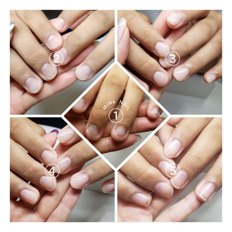 噛み爪 深爪 育成コース Before After Mins Nail ミンスネイル のこだわり特集 ネイル まつげサロンを予約するなら楽天ビューティ