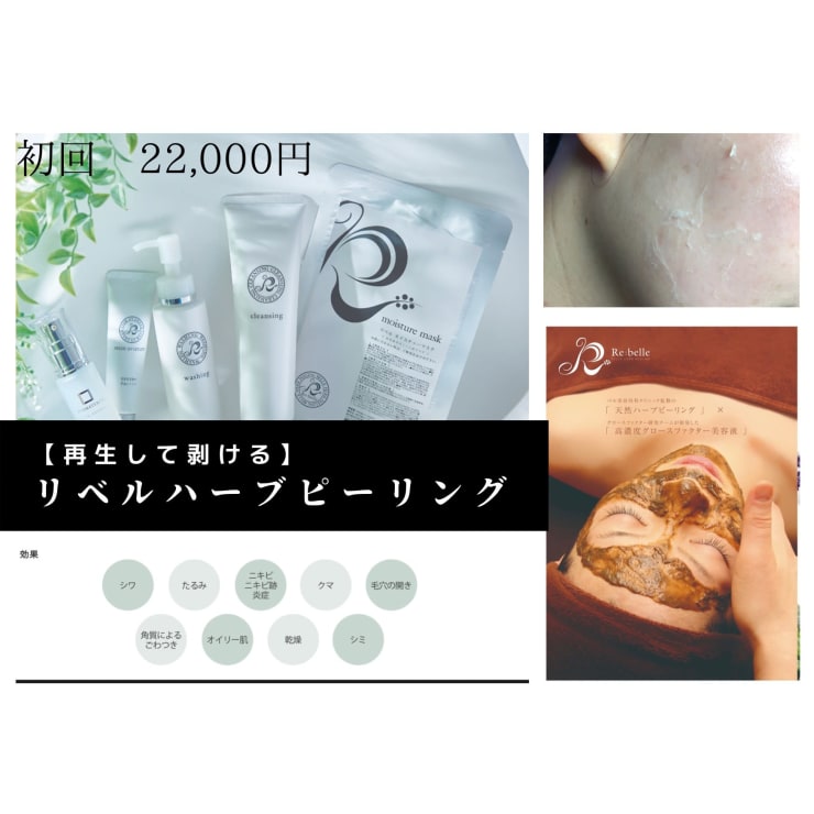 剥離あり】リベルハーブピーリング 初回22,000円 | 美肌脱毛専門サロン