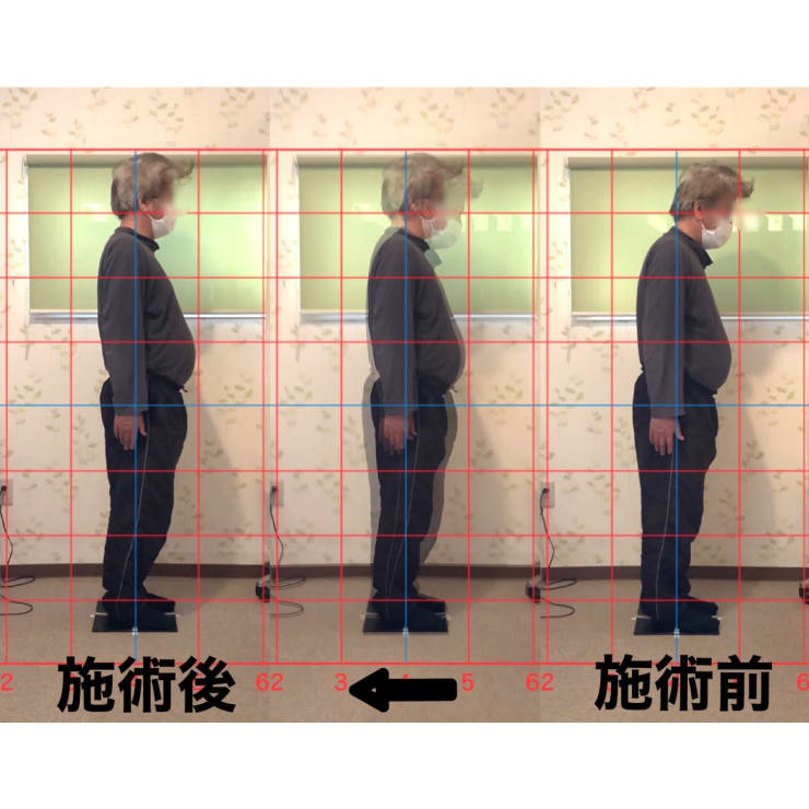 関節調整 10秒プログラム 劇的ビフォーアフター！ 関節調整マスター　整体 劇的ビフォーアフター！ 関節調整10秒プログラム | 医療情報研究