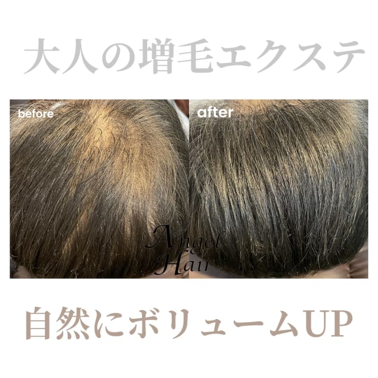 増毛エクステ☆エアリーアクステ“エアエク” | AngelHair【エンジェル 