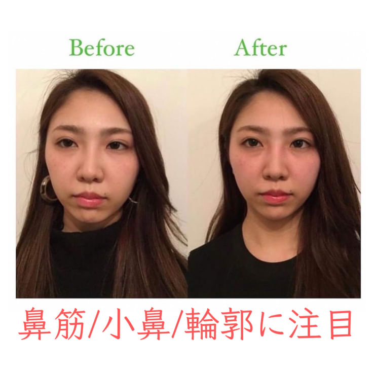 顔から姿勢を正す整顔術〜健美両立型のアプローチ〜 顔から姿勢を正す整顔術〜健美両立型のアプローチ〜 顔