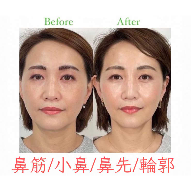 姿勢矯正・美容整体と頭蓋骨小顔矯正を受けていただきました