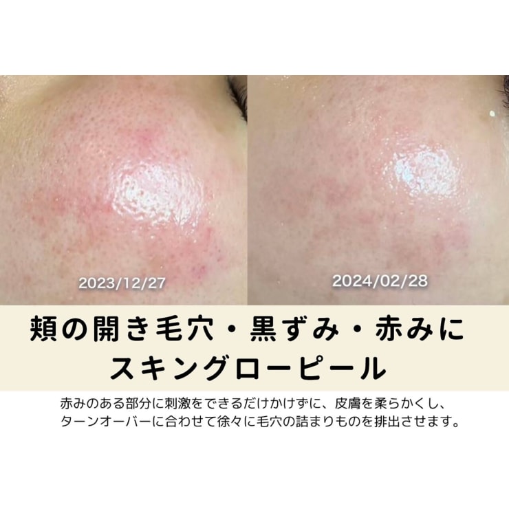 毛穴ケアをしたい | KOKYU GINZA Skincare & Healthcare(コキュウ 