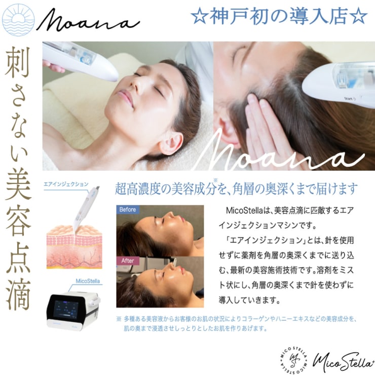 Mico Stella（ミコステラ）が神戸に上陸☆超高濃度美容液をお肌の