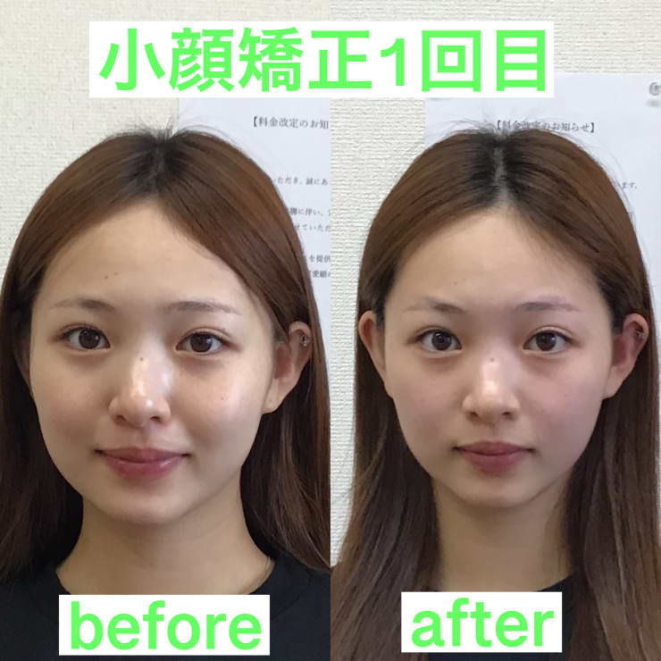 萩原式小顔矯正 オズ六本木(ハギワラシキコガオキョウセイ オズロッポンギ)のお店の雰囲気 | リラク・マッサージサロンを予約するなら楽天ビューティ