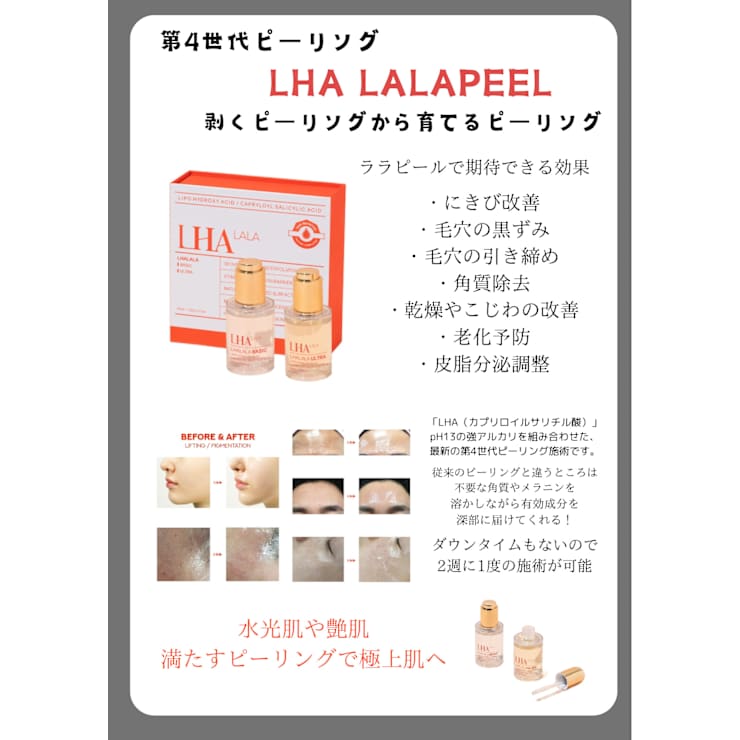 韓国肌管理】ララピール&毛穴洗浄19,800円→9,800円 | ANERA Second