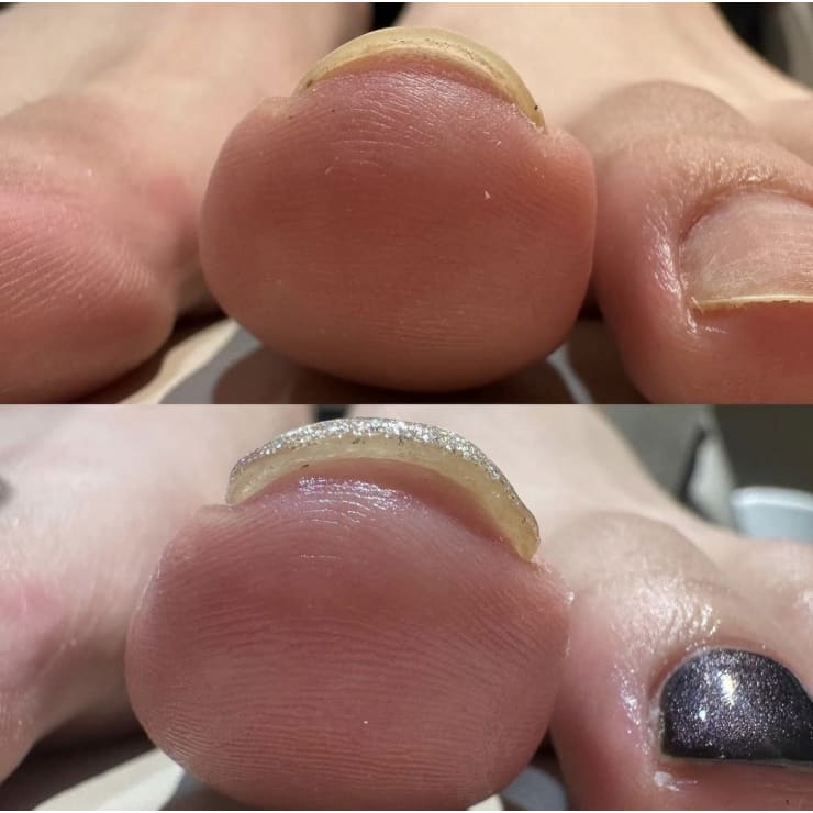 Sgnjaページ　　TOEMED 4本セット&新品3本セット TAT - TOEMED - ケアジェル