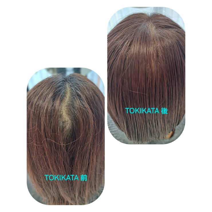 トキカタ　tokikata TOKIKATA(トキカタ)で悩み解消♪ | Hair & Spa y‐Forme Ginza(ヘア