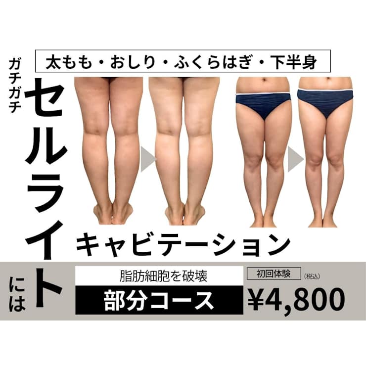 値下げしました！エステ　痩身　キャビテーション ガチガチ脂肪燃焼・下半身に】膜を破壊!キャビテーション部分コース