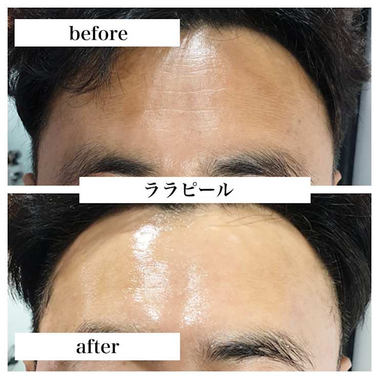 1度でツヤ・ハリ・トーンアップ実感♪ララピール | Lino me(リノミー