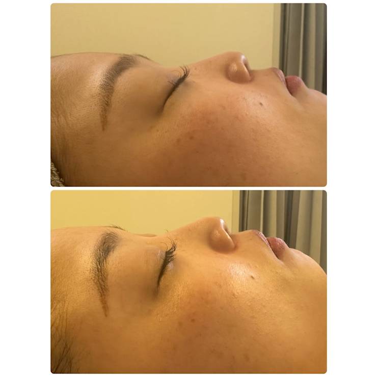 1度でツヤ・ハリ・トーンアップ実感♪ララピール | Lino me(リノミー