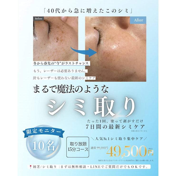 40代から急に増えたシミ、「もう取れないかも」と 諦めてしまっている